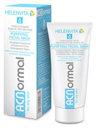 Helenvita Acnormal Purifying Facial Mask 75ml